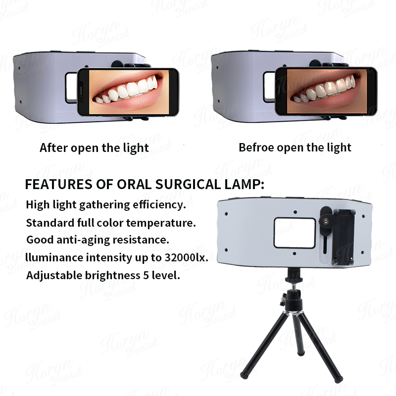 Luz de Flash Dental, equipo de - Photography Lighting Led reseña y precio